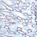 LONP1 Polyclonal Antibody