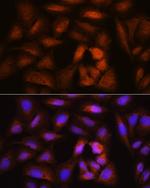 NCAPH Polyclonal Antibody