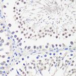 PBK Polyclonal Antibody