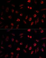 NEDD1 Polyclonal Antibody