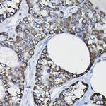 GSTK1 Antibody in Immunohistochemistry (Paraffin) (IHC (P))