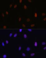 H3K14me1 Antibody in Immunocytochemistry (ICC/IF)