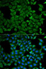 ATL1 Polyclonal Antibody