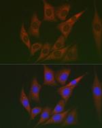 LUM Polyclonal Antibody