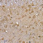 GFR alpha-1 Antibody in Immunohistochemistry (Paraffin) (IHC (P))