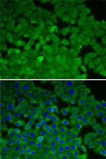 EEF2K Polyclonal Antibody