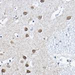 ORC6 Polyclonal Antibody