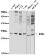 ORC6 Antibody in Western Blot (WB)