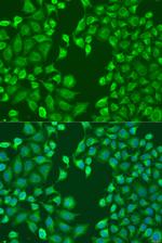 MERTK Polyclonal Antibody
