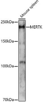MERTK Antibody in Western Blot (WB)