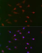 CDC34 Polyclonal Antibody