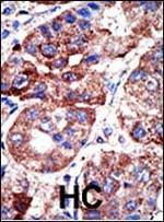 SQSTM1 Antibody in Immunohistochemistry (Paraffin) (IHC (P))
