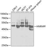 hnRNP F Antibody in Western Blot (WB)