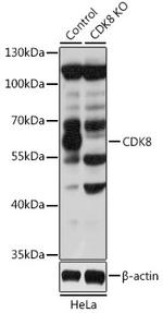 CDK8 Polyclonal Antibody