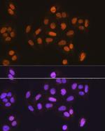 MCM5 Polyclonal Antibody