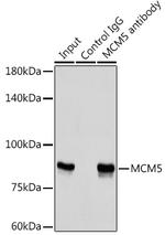 MCM5 Antibody in Immunoprecipitation (IP)