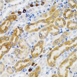 PGRMC1 Antibody in Immunohistochemistry (Paraffin) (IHC (P))