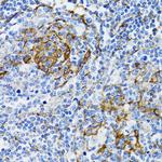 PGRMC1 Antibody in Immunohistochemistry (Paraffin) (IHC (P))
