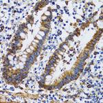 PGRMC1 Antibody in Immunohistochemistry (Paraffin) (IHC (P))