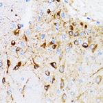 PGRMC1 Antibody in Immunohistochemistry (Paraffin) (IHC (P))
