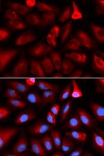 FKBP4 Polyclonal Antibody