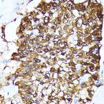 FKBP4 Antibody in Immunohistochemistry (Paraffin) (IHC (P))