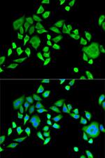 SH3GL2 Antibody in Immunocytochemistry (ICC/IF)