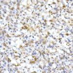 SMARCB1 Antibody in Immunohistochemistry (Paraffin) (IHC (P))