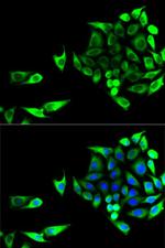 GOT1 Polyclonal Antibody