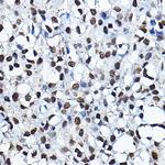 MYST2 Polyclonal Antibody