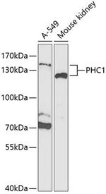 PHC1 Polyclonal Antibody