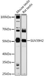 SUV39H2 Polyclonal Antibody