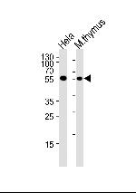 Chk1 Polyclonal Antibody