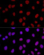 Ku80 Polyclonal Antibody