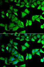 RPS12 Antibody in Immunocytochemistry (ICC/IF)