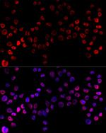hnRNP H1 Antibody in Immunocytochemistry (ICC/IF)