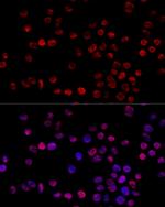 hnRNP H1 Polyclonal Antibody