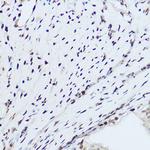 hnRNP H1 Antibody in Immunohistochemistry (Paraffin) (IHC (P))