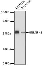hnRNP H1 Antibody in Western Blot (WB)
