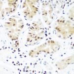 AGO2 Polyclonal Antibody