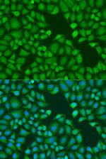 TNRC6A Polyclonal Antibody