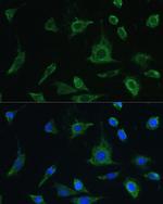 Oncostatin M Polyclonal Antibody