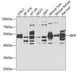 IRF6 Polyclonal Antibody