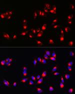 Melan-A Polyclonal Antibody
