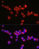 Synaptophysin Polyclonal Antibody