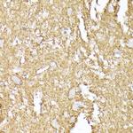 Synaptophysin Antibody in Immunohistochemistry (Paraffin) (IHC (P))