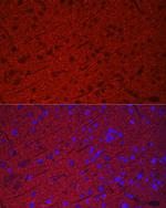 Synaptophysin Antibody in Immunohistochemistry (Paraffin) (IHC (P))