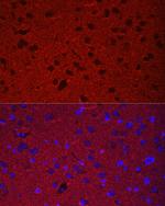 Synaptophysin Antibody in Immunohistochemistry (Paraffin) (IHC (P))