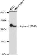Arginase 2 Polyclonal Antibody