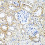 ASL Antibody in Immunohistochemistry (Paraffin) (IHC (P))